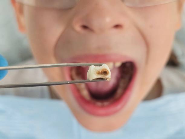 Best Pediatric Emergency Dentist in Camden, TN