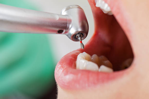 Best After-Hours Dental Trauma Care in Camden, TN